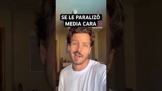 MEDIA CARA no le RESPONDE - Parálisis de bell