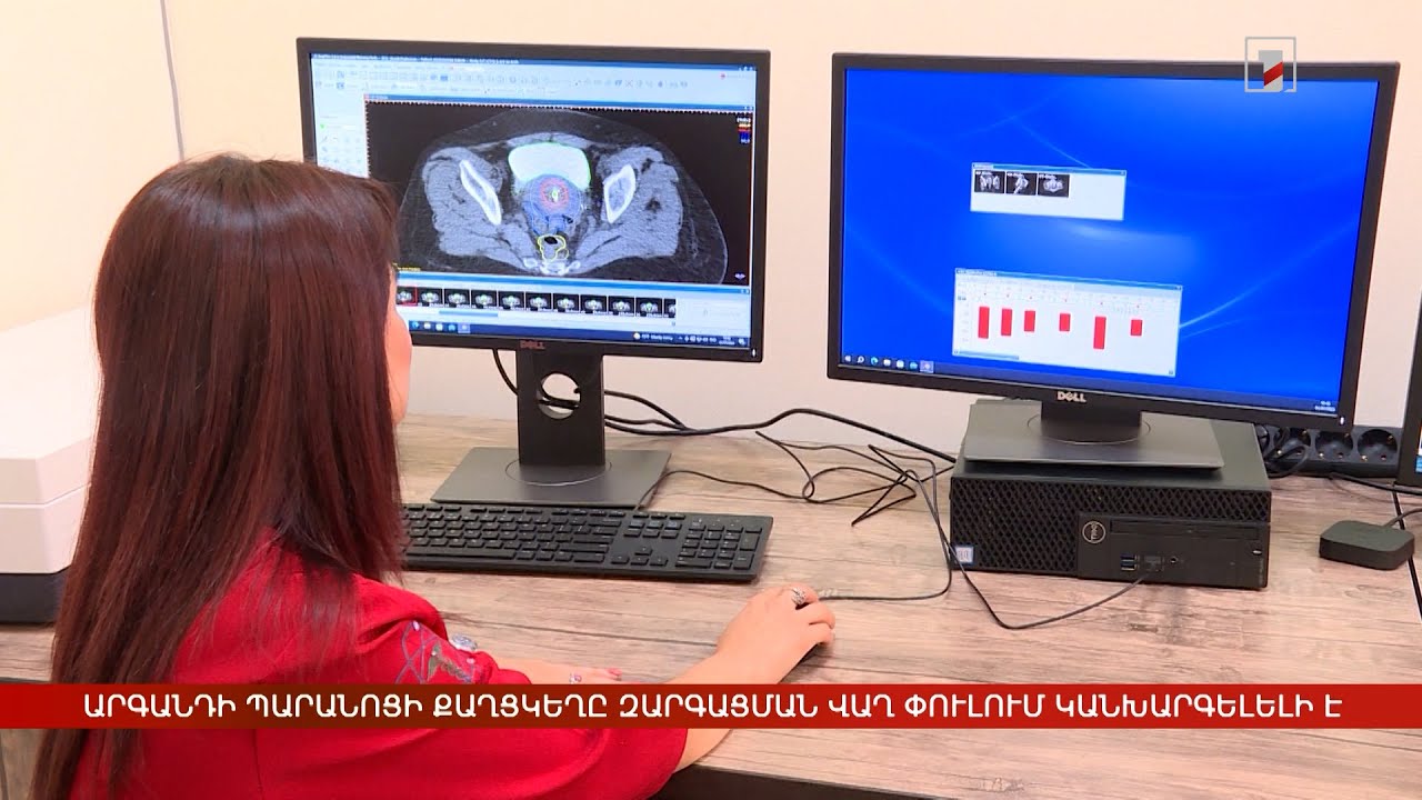 Արգանդի պարանոցի քաղցկեղը զարգացման վաղ փուլում կանխարգելելի է