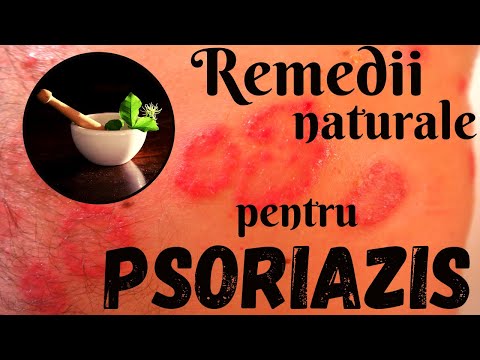 hogyan kezelik a psoriasisot Japnban