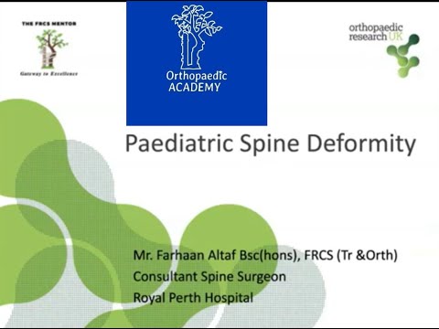 Paediatric Spine Deformities