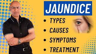 Jaundice | Types Causes Symptoms and Treatment