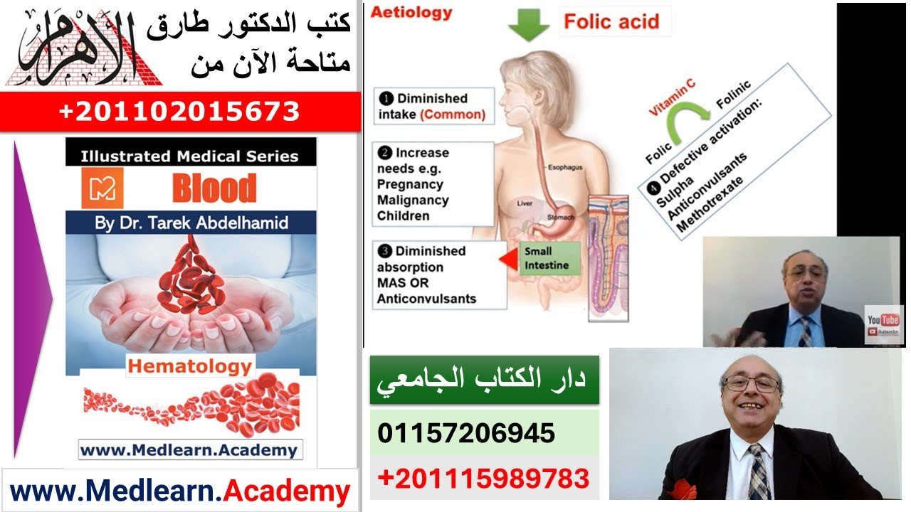 Megaloblastic Anemia    #cme #internal_medicine #medical #medicalstudent  #usmle #محاضرات_باطنة