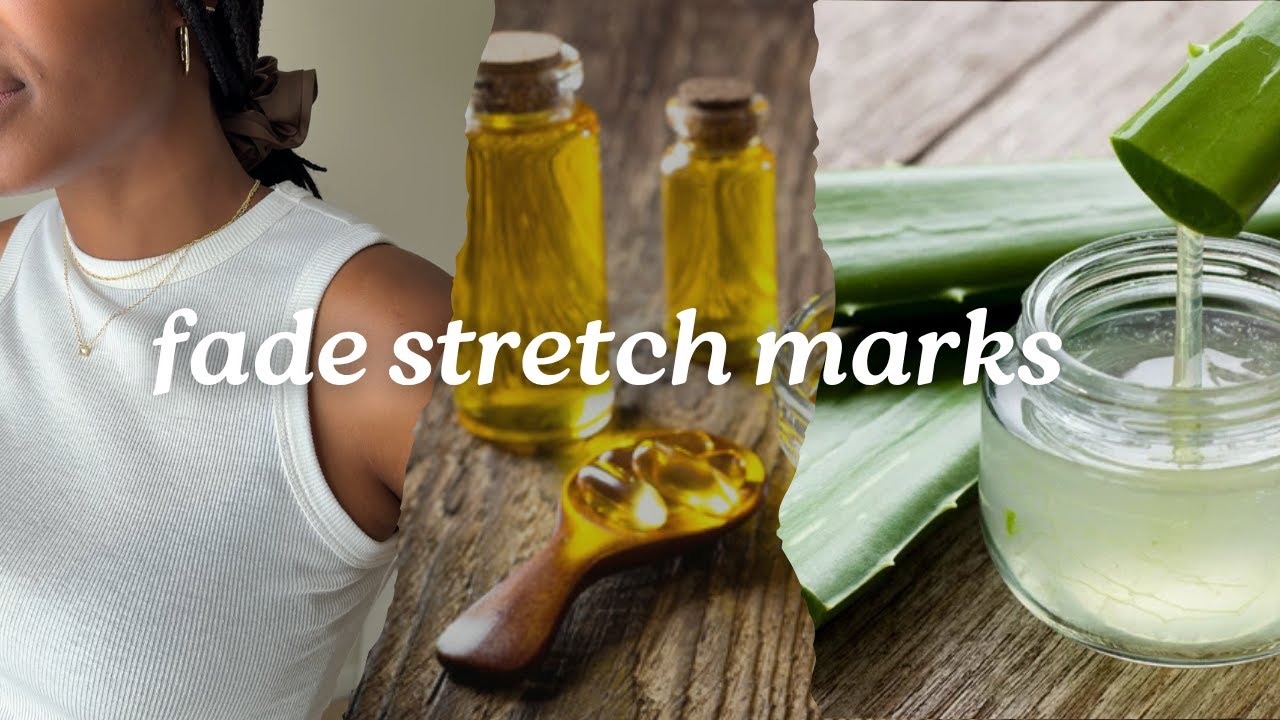 How I faded my stretch marks w/ aloe vera | 1 week results!