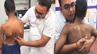 Ankylosing spondylitis treatment ll Dr Harivansh Y