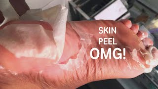 I tried a Foot Peel Mask & The results?! 😱😱😱 | Healing Cracked Heels!!
