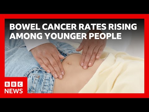 Scientists investigate why more young people are getting bowel cancer | BBC News