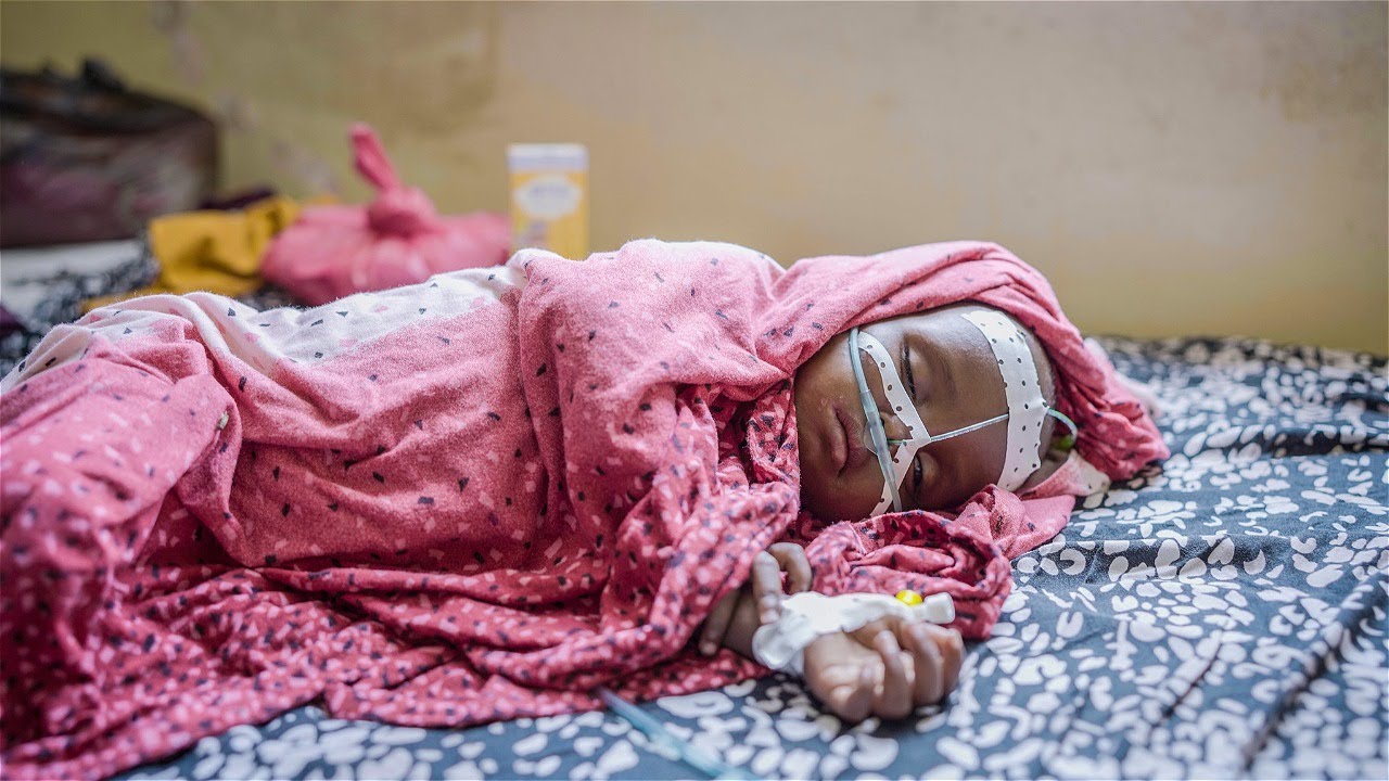 The cost of missed vaccinations and the power to prevent