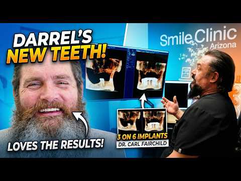 Problemas dentales de 30 años a una sonrisa completamente nueva con 3 de 6 - Dr. Fairchild, Arizona