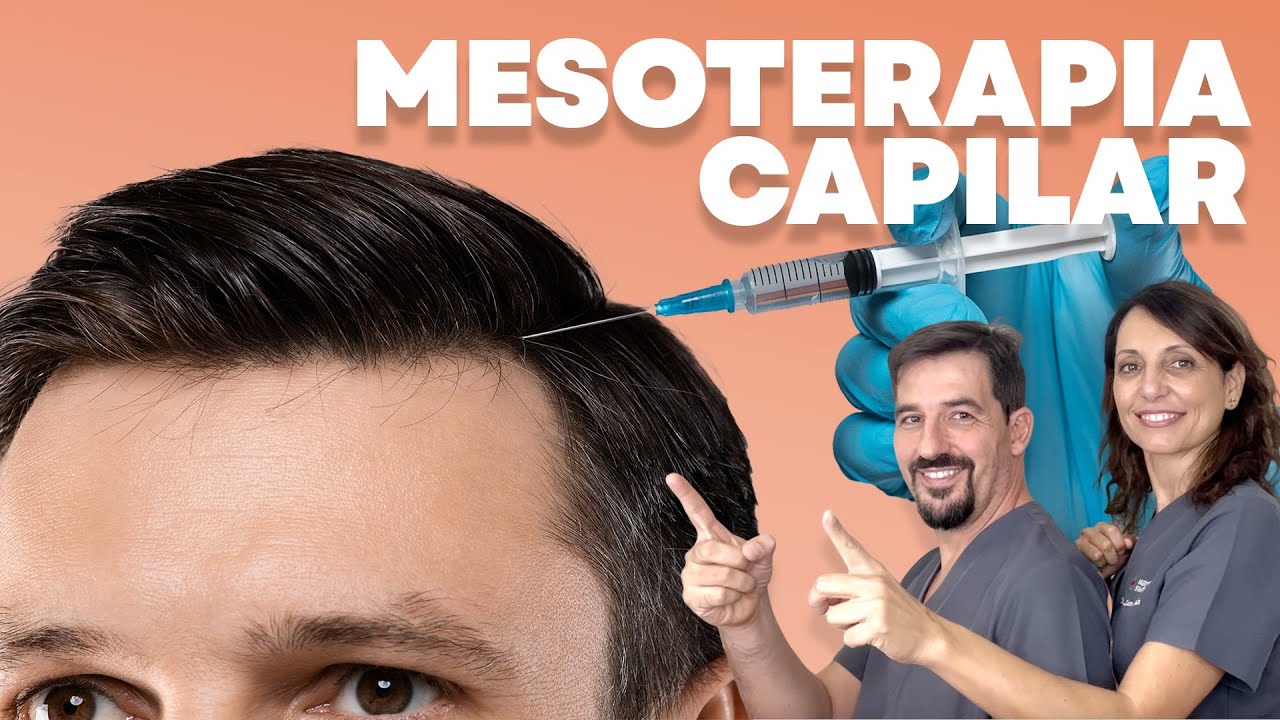 🔴 Capillary Mesotherapy: Scam or Effective?