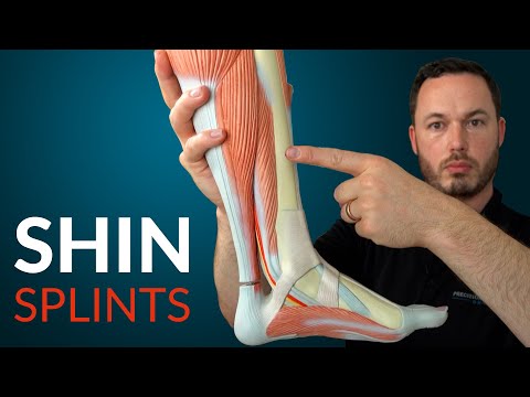 Understanding SHIN SPLINTS and how to fix it.