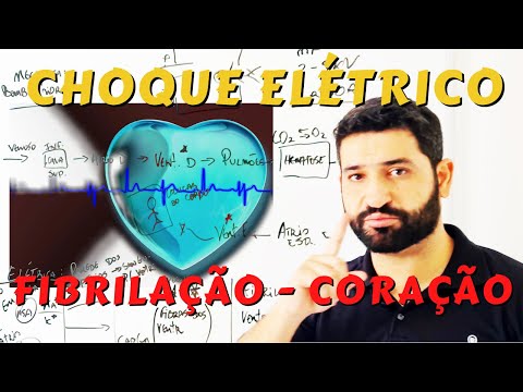 Como o Choque Elétrico Poda Matar Causando a Fibrilação Ventricular no Coração Humano ?