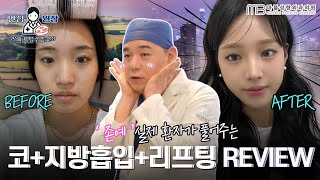 원장님이 감사하다고 한 이유?! 존예 실제 환자 [코+지방흡입+리프팅] 리얼 리뷰영상