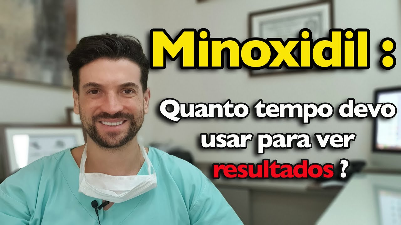 Minoxidil :quanto tempo devo usar para ter resultado ?