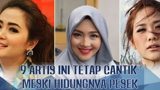 Download lagu BOHAY SICH! 9 Artis ini Tetap Cantik dan Menawan Meski Hidungnya Pesek mp3