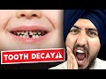 How To NEVER Get Another Cavity Again