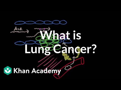 What is lung cancer? | Respiratory system diseases | NCLEX-RN | Khan Academy