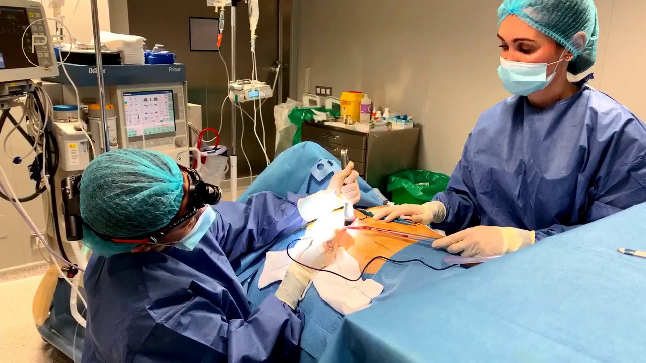 ¿CÓMO es una CIRUGÍA DE AUMENTO DE PECHO