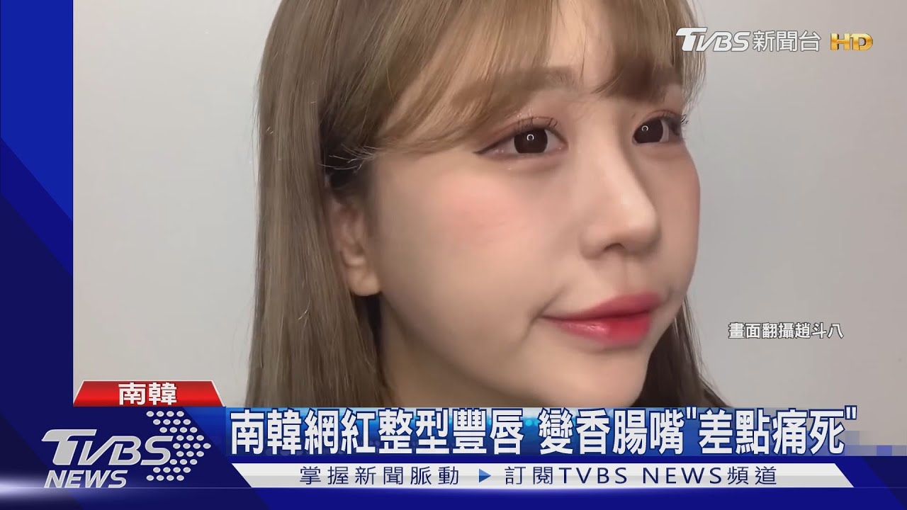 南韓網紅整型豐唇 變香腸嘴「差點痛死」
