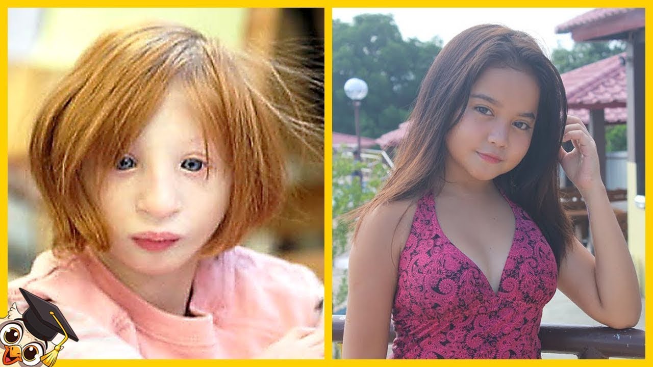 20 Crianças Que Nascem Apenas Uma Vez A Cada Mil Anos