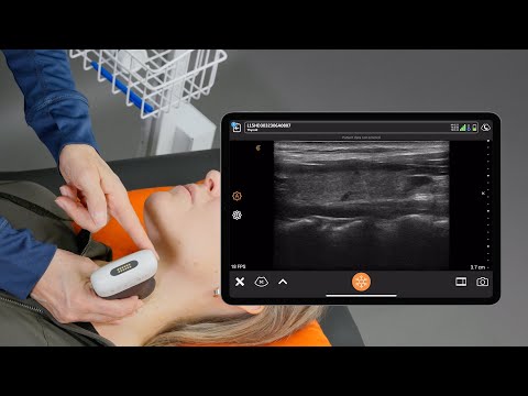 Anatomy of an Ultrasound Image