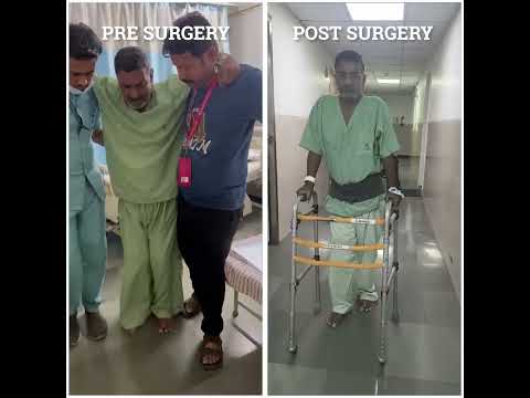 Before & After Spine Surgery: Real Patient Results | Dr. Ajay Kothari