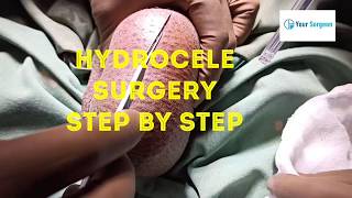 HYDROCELE operation step by step