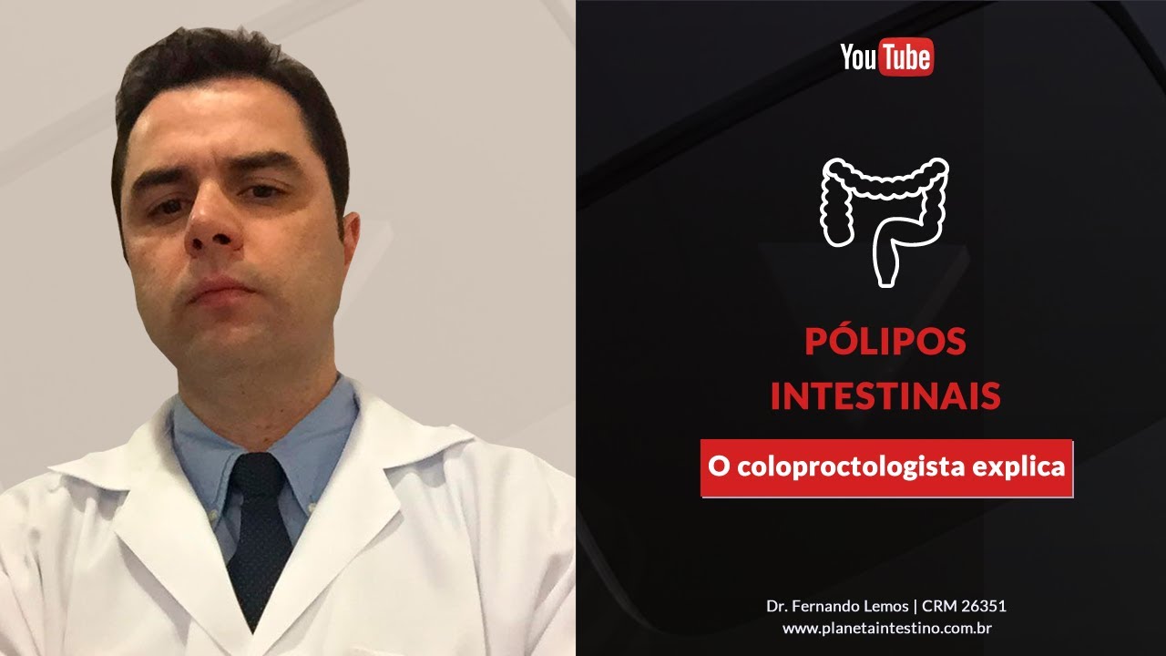 Pólipos Intestinais! O Coloproctologista explica.