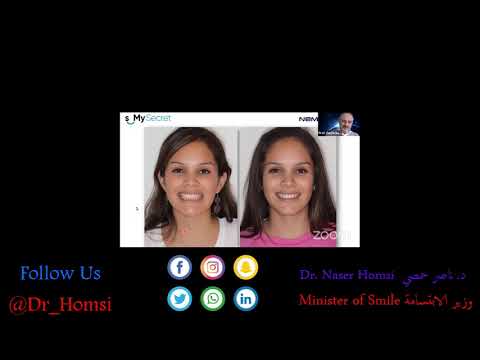 Melhor Palestra d Odontologia para Faculdade para Estudantes Odontologia e Dentistas Dr. Naser Homsi
