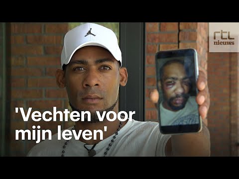 Rushen werd bruut aangevallen door politiehond