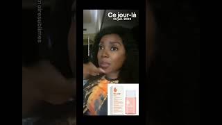 comment utiliser bio oil sur le visage ? #blogger #skincare