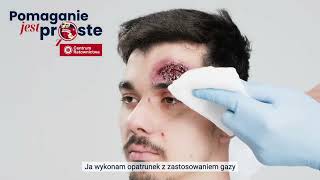 Uraz głowy