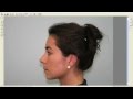 Hump Reduction Rhinoplasty Introduction Explanation Dr Thomas Buonassisi Vancouver BC