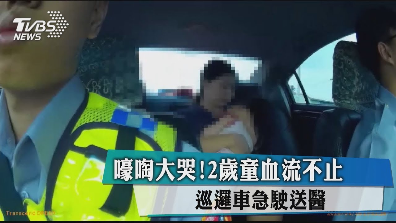 嚎啕大哭！2歲童血流不止　巡邏車急駛送醫