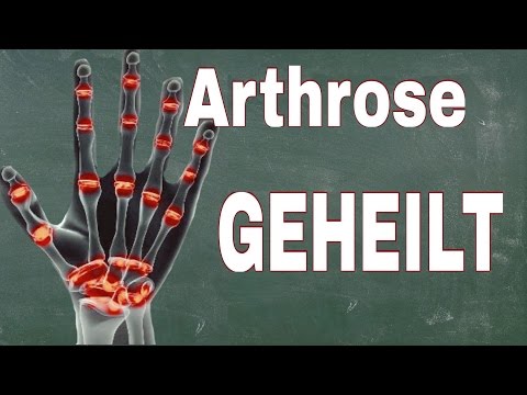 Nackenschmerzen Erste Hilfe Schmerzen in der Rückseite des Kopfes Schmerzen nauseated