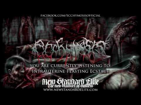 Ecchymosis - “Intrauterine Feasting Ecstacy” (Aberrant Amusement In Cadaveric Vomitplay 2016 | NSE)