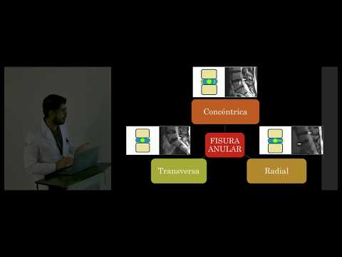 Precio MRI conjunta Jarkov ¿Cuál es la resección del menisco de la articulación de la rodilla