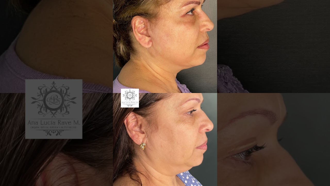 Ana Lucia Rave Martinez-22