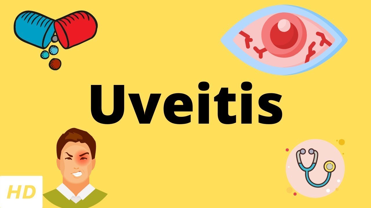 Uveitis, Causes, Signs and Symptoms, Diagnosis and Treatment. - YouTube