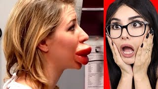 Allergic Reaction GONE WRONG