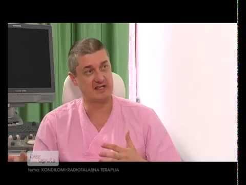 Bez uputa Atlas TV Tema Kondilomi   radiotalasna terapija 11052013 23