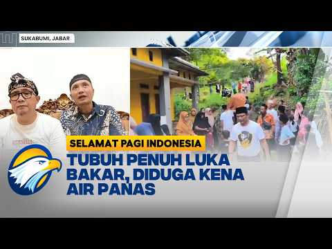 Dugaan Kekerasan Anak di Sukabumi: Polisi Dalami Keterkaitan Luka Bakar dan Alibi Penyakit