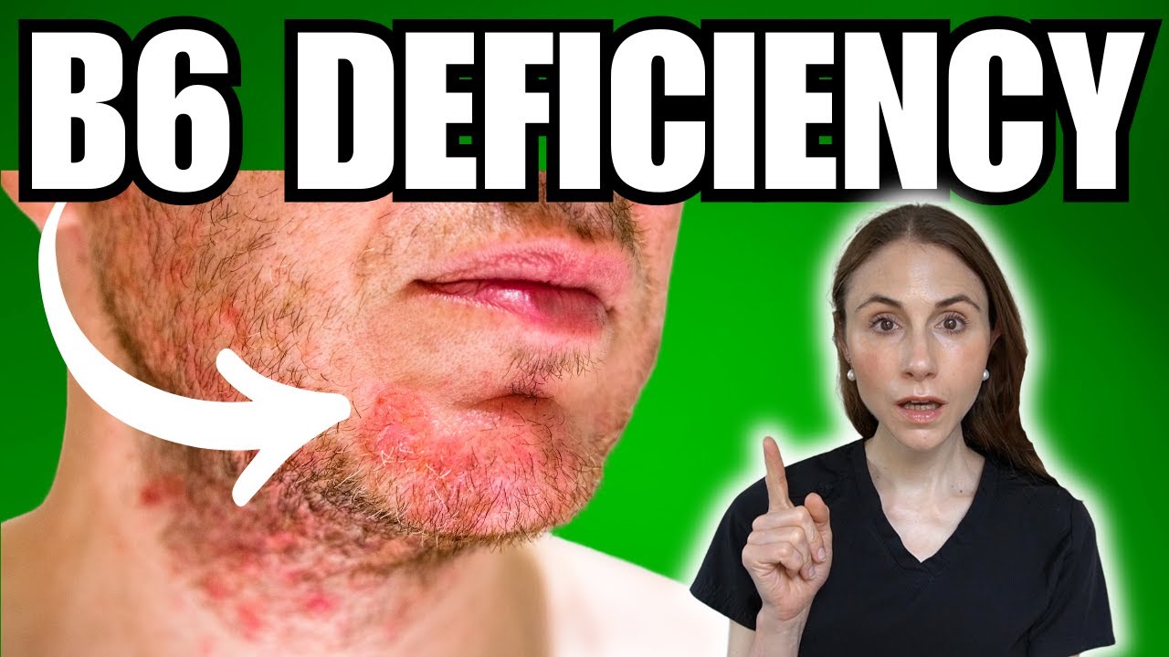 5 Warning Signs Of Vitamin B6 Deficiency NOT TO MISS