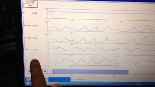 Ford Electronic Throttle Body Failure Diagnosis