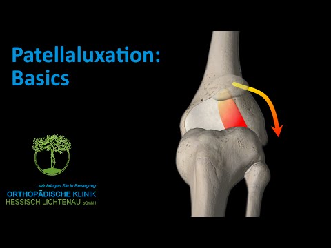 Carboxytherapie der Osteochondrose Sport mit Bandscheibenbruch