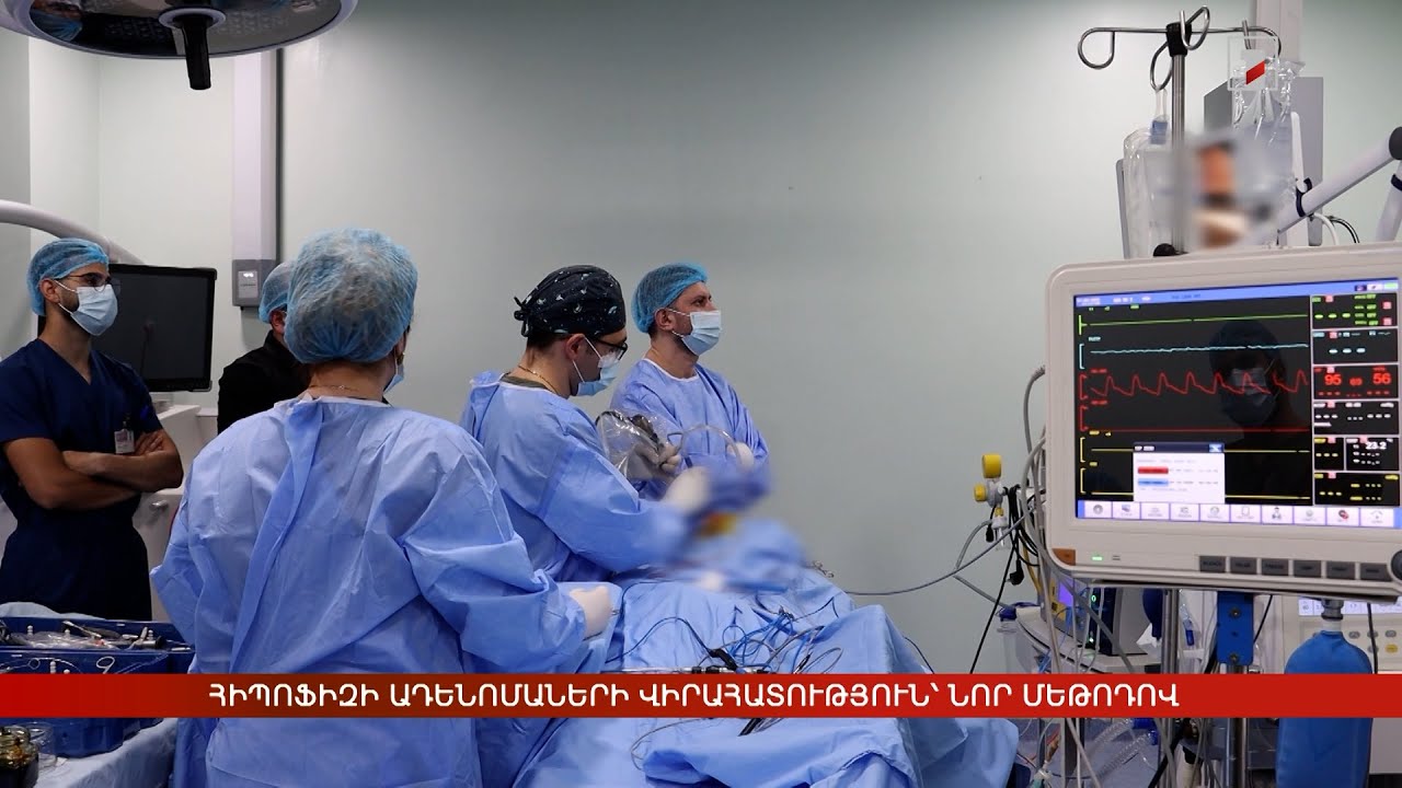 Հիպոֆիզի ադենոմաների վիրահատություն՝ նոր մեթոդով