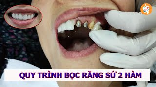 Bọc Sứ Thẩm Mỹ ở Nha Khoa Đại Phát - Biên Hòa