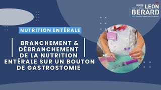 Branchement et débranchement nutrition entérale sur bouton gastrostomie