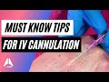 Important tips and tricks for IV cannulation!