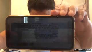 Dr  gets COVID symptons here's his labcorp antibody test results