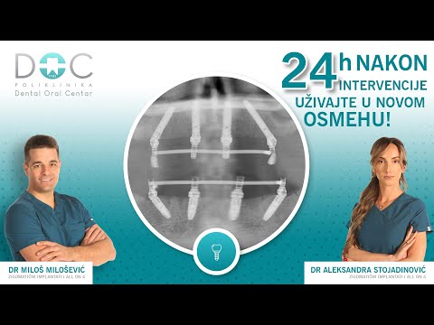 Iskustvo oduševljenog pacijenta - tehnika All On 4 - Dental Oral Centar